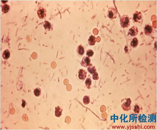 志贺氏菌检测